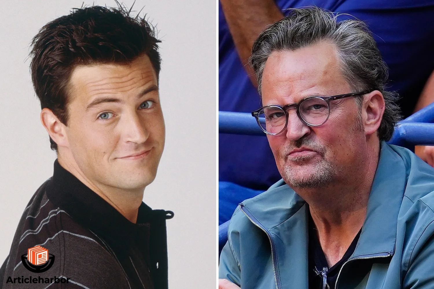 Matthew Perry Teeth